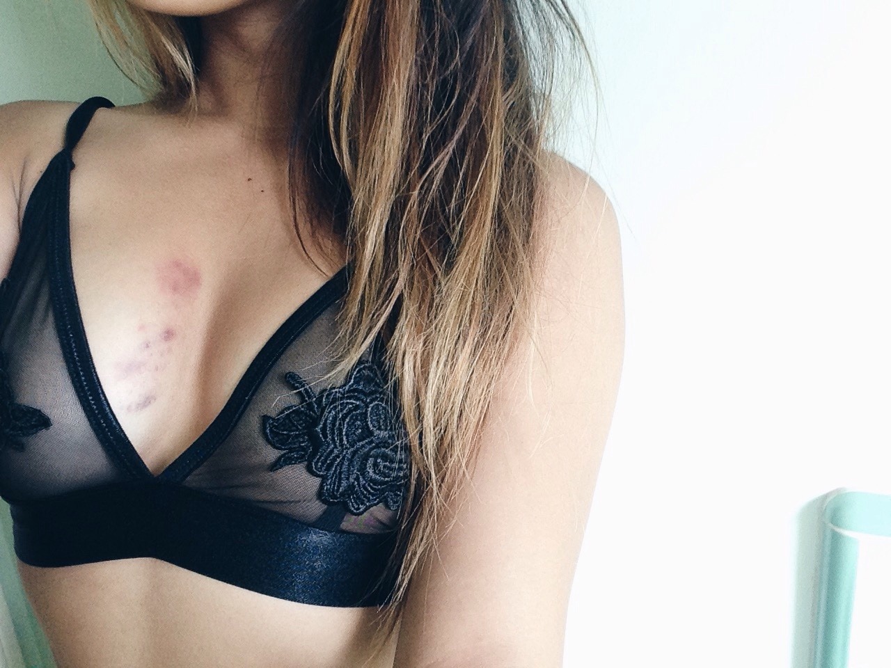 solipsity:  It’s not a hickey if you didn’t post it on tumblr