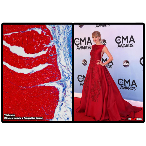 Taylor Swift as Histological Stains, a thread i♡histo 