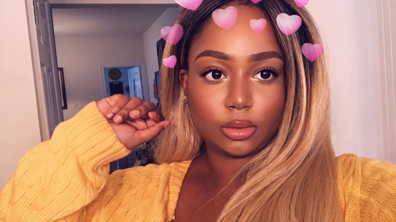 lucidnee:  lorrydii:  lucidnee:  hey  little chin dimple!!! you are so beautiful,