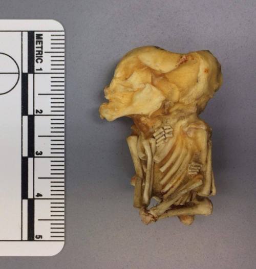 brains-and-bodies: From Osteocentric Skeletonized 13-14 week old fetus from an ectopic pregnanc