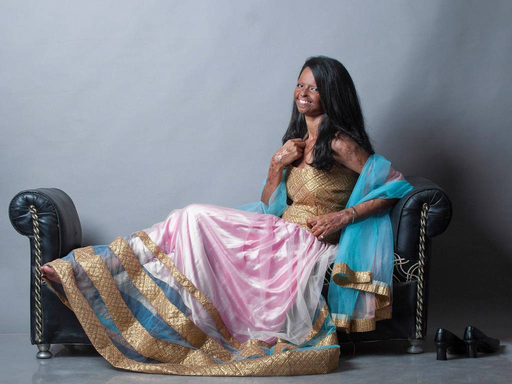 myvoicemyright:   Acid attack survivors in India model new clothing range for powerful