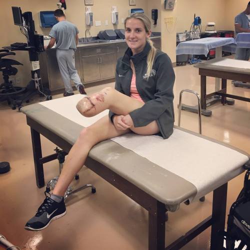 dreamputees: phelddagrif: Marine Kirstie Ennis who had her damaged left leg amputated below the knee