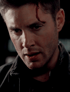 dustydreamsanddirtyscars: #DEAN APPRECIATION WEEKSUNDAY: A Set Dedicated to Dean // Bruised, Bloody and Still Utterly Beautiful
