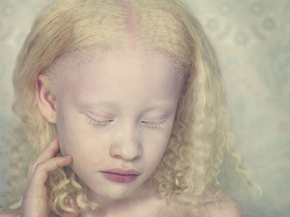 jareth-gates:  likeafieldmouse: Gustavo Lacerda - Albinos (2009-12) 