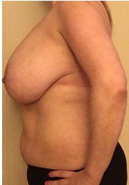 justbigasstitties:  45 years old. 32H/J. Damn! Milf with some BIG titties on her!!