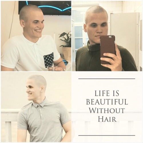 a8007399033: Enjoy your life, be bald! Be bald by choice! Be tough! #baldbychoice #burr #buzzcut #he