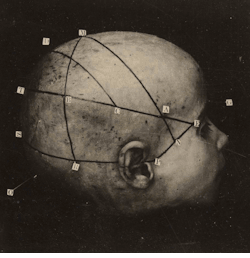 cabinetpapaver:  Petit montage de vues stéréoscopiques de la dissection d’une tête humaine datant de 1909