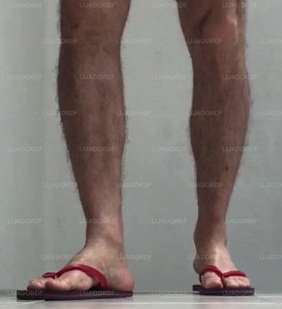 HAIRY LEGS