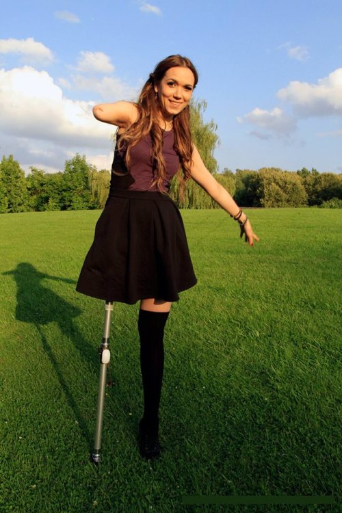 ilikeamputees: ilampmta: Love Jessica!  (via TumbleOn)