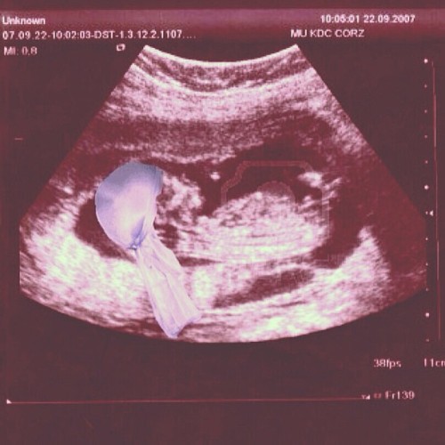 kimdash:  It’s a boy ! 