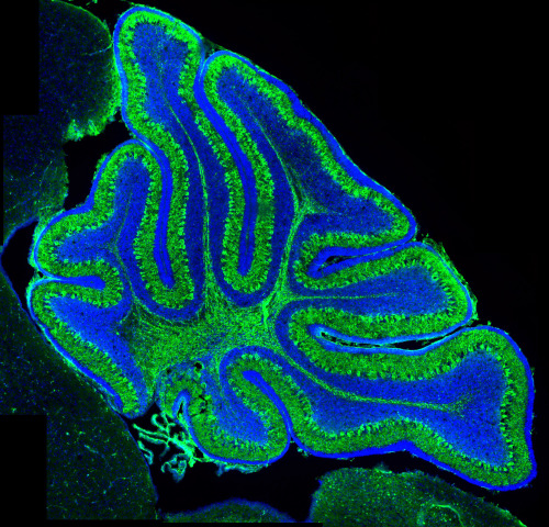 usefulmistakes:ALS-linked gene found switched on in new bits of the brain ALS, also known as Motor