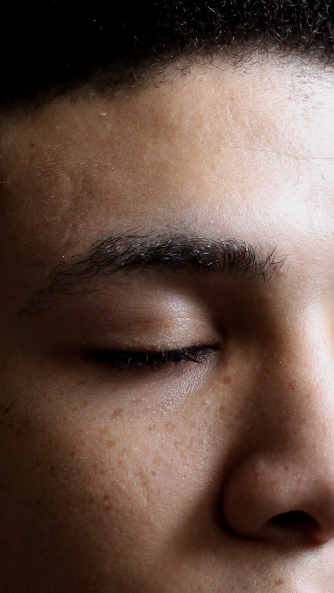 nembhard:MY SKIN.
