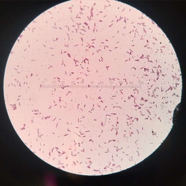 spore stain spore stain