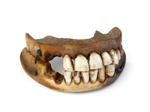 Waterloo Teeth,In the 18th and 19th century dentures were made from a variety of materials; ivory, b