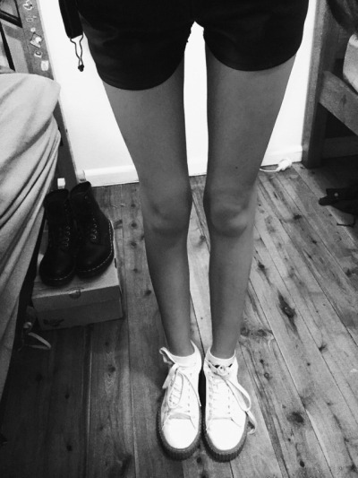 Thigh Gap Pics Tumblr