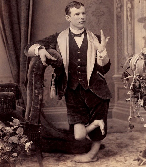 carnytrash:  resonanceinthehalls:  Vintage Photography of Circus ‘freaks’ and