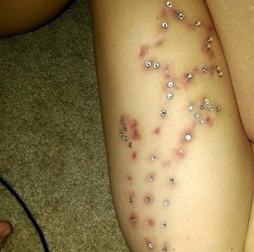 saintsabrinas:  A few different versions of this failed 71-piece microdermal/surface anchor/single-point surface piercing project have started making the rounds and we wanted to share our thoughts and hopefully provide some additional insight and context