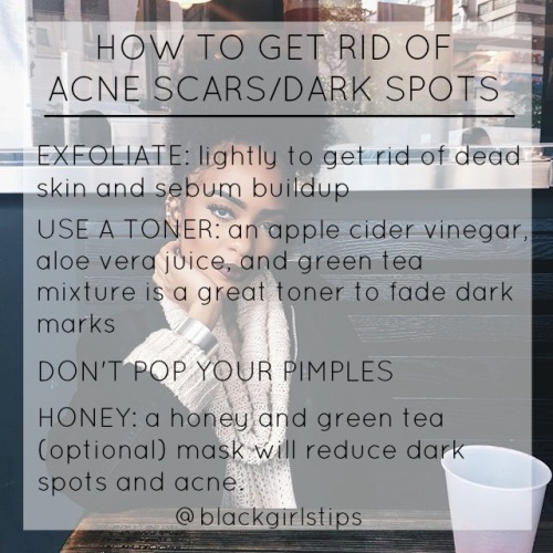 blackgirlstips:How to Get Rid of Dark Spots/Acne Scars