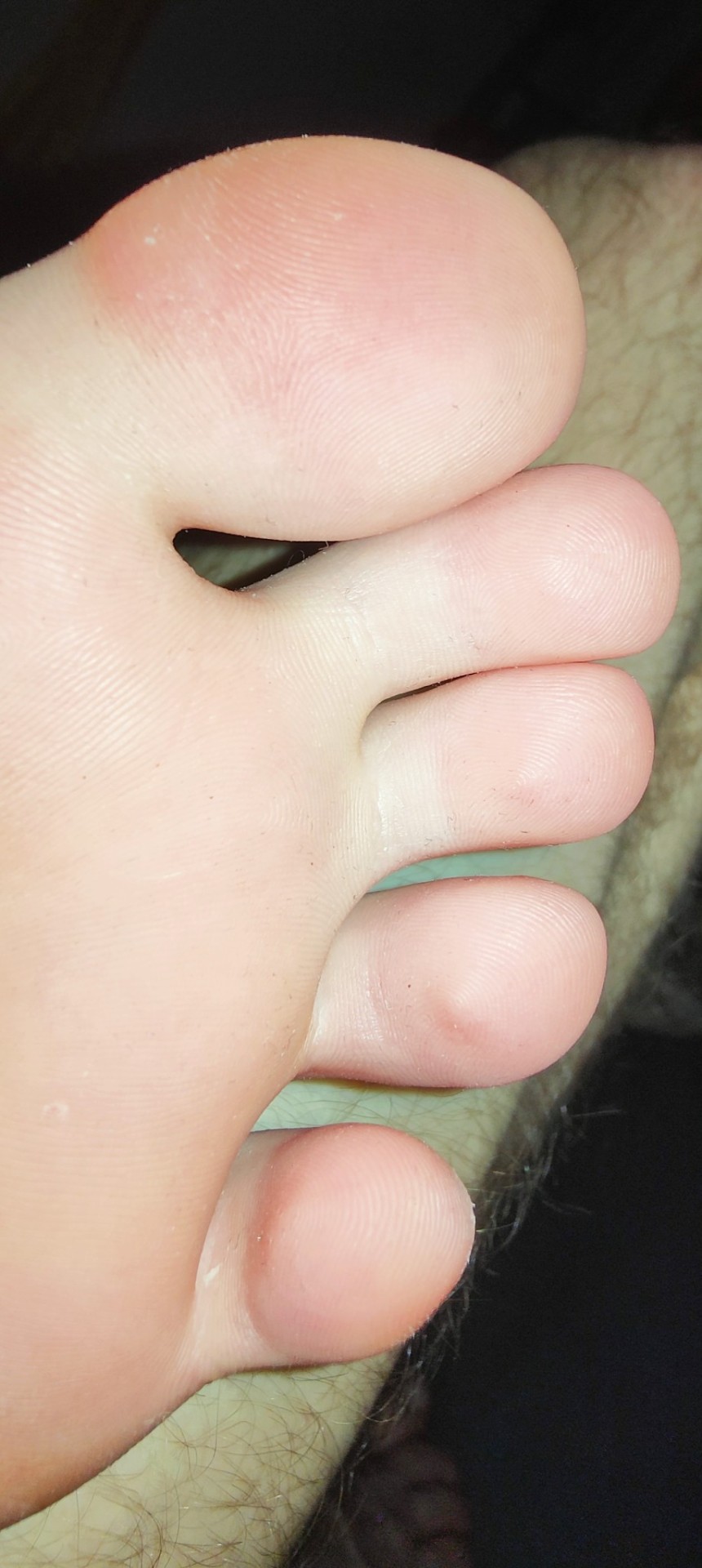 I'm Very Ticklish Between My Toes