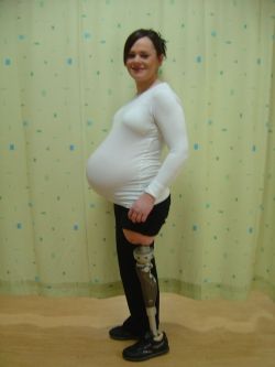 tau-01:  amputee SAK pregnant   This Woman