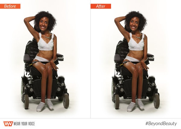 huffingtonpost:       11 Fearless Images That Push Us To Rethink What ‘Beautiful’