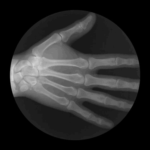 bluecaptions:  X-ray GIFs showing joints in motion.