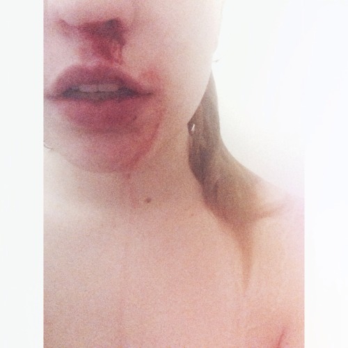 My Monthly Shower Nose Bleed