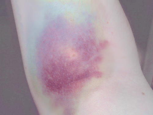 http://bcvh.tumblr.com/post/60893211361