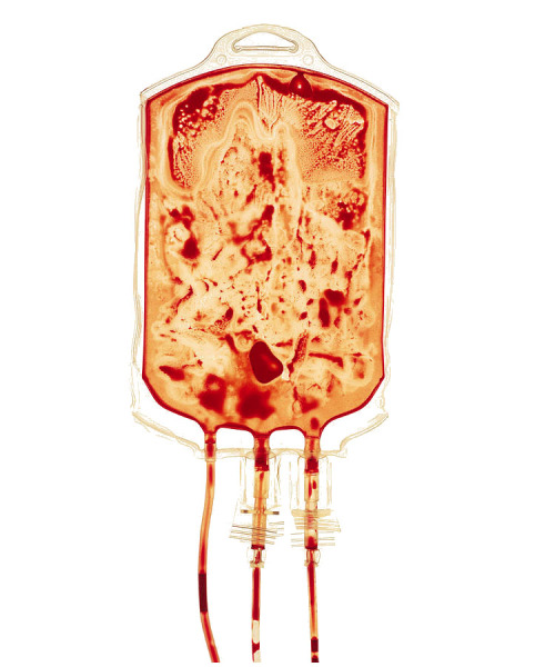 Part 3: A Bloody Gruesome Mystery Continues