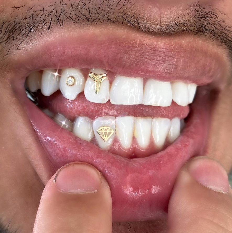 Body Modification Nation Tooth Gems by drip gems