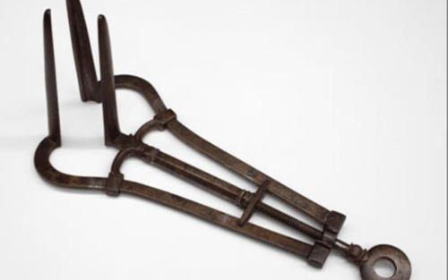 peashooter85:The Anal Fistula of King Louis XIV,In 1685, King Louis XIV of France began to feel a te