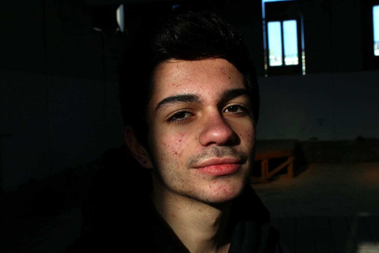 hiraeeeth:some photos of my photoproject which is called “Redefining beauty ”
