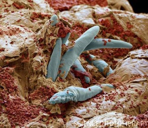 These are Demodex. They live around the base of your eyebrows and eyelashes and lay eggs inside your