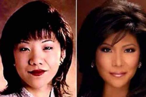 18mr:I think it’s great that Julie Chen decided to be upfront about her eyelid surgery, and for call