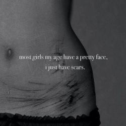 depressed&ndash;and&ndash;lonely&ndash;girl:  La mayoría de las chicas de mi edad tienen una cara bonita, y yo… yo sólo tengo cicatrices. 