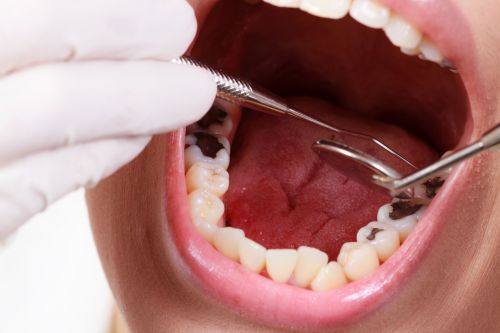 A dental checkup, I love the fillings&hellip;