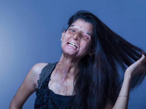 redsuelo:amberrosehairline:myvoicemyright:Acid attack survivors in India model new clothing range fo