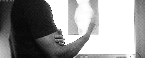 lonewolfed:derek’s hands/arms in 3.02