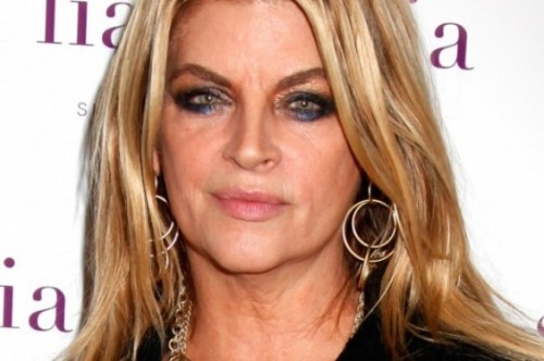 http://www.plasticsurgeryindex.com/kirstie-alley-facelift.html
