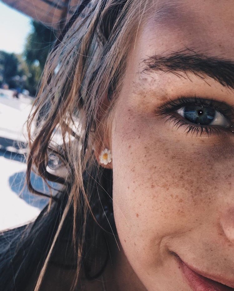 🦋