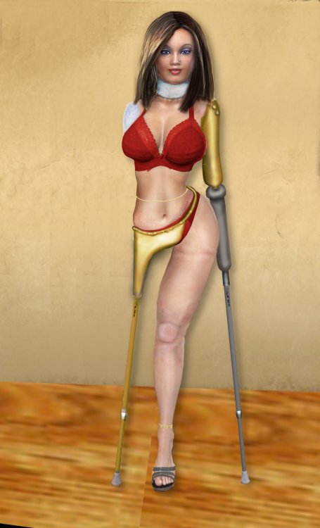 variants of prostheses