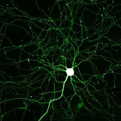 diamidinophenylindolee:  Hippocampal neuron