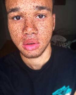 freckledlightskin:  Whoever tells you freckles