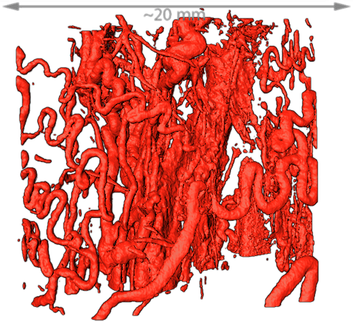 “Sample microCT image (vasculature of a mouse hindlimb - 10 micron pixel size)”