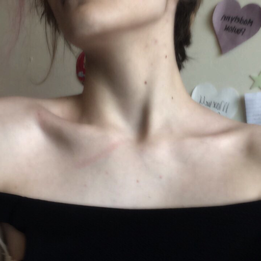 violentgghost:  meanspo here: watch out. i just don’t understand how all of you reblog thinspo and say you have anorexia yet day after day your weight isn’t changing? everyone seems to be around 5’4” and 120 lbs and i can’t seem to understand