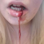 scarredlittlegirl