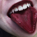 just-some-haematophilia:  