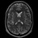 homo-medicus:  Bypass for Complex Basilar