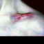 9814108-blog