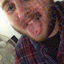 billyedwarddewdap